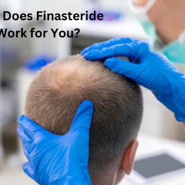 How Does Finasteride Work for You?